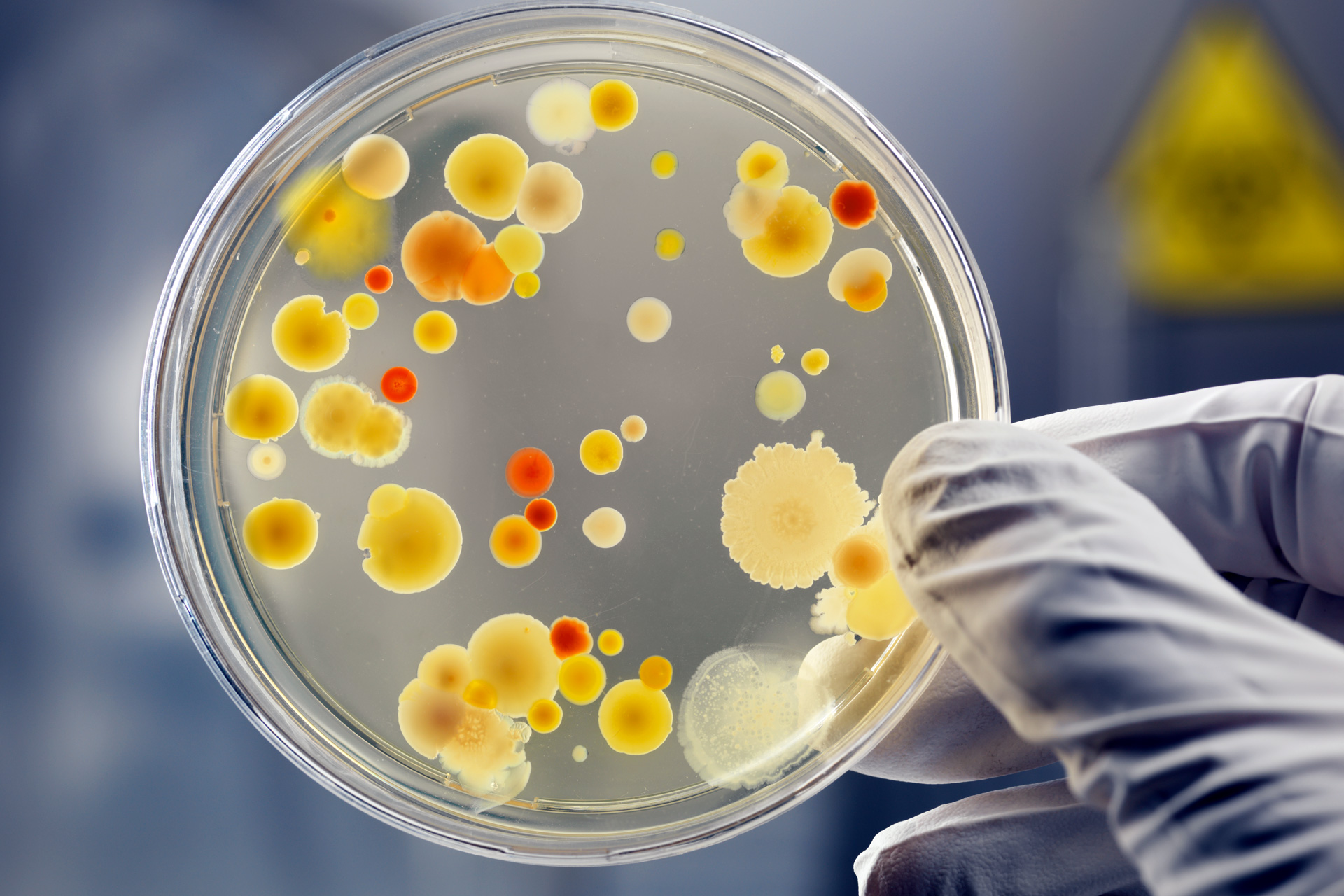 Microbial culture in a petri dish